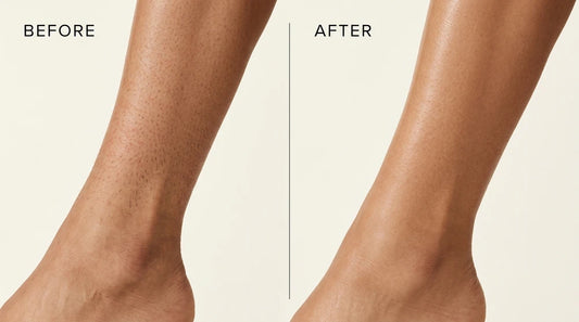 Cyperus Rotundus Hair Removal Oil
